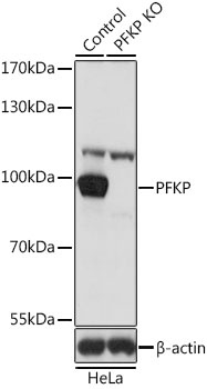 PFKP Antibody