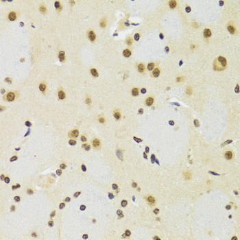 SUZ12 Antibody