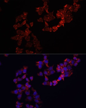 SUZ12 Antibody