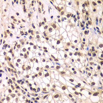 SMARCC1 Antibody
