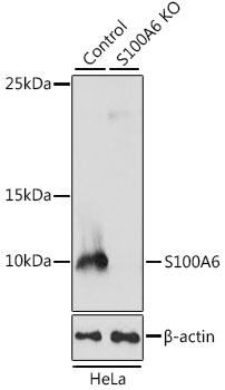 S100A6 Antibody