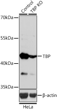 TBP Antibody