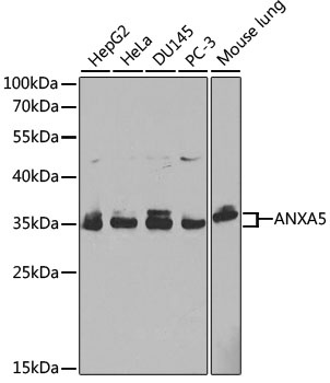 ANXA5 Antibody