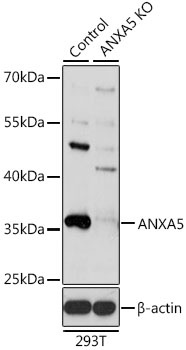ANXA5 Antibody