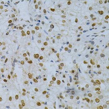 ELAVL1 Antibody