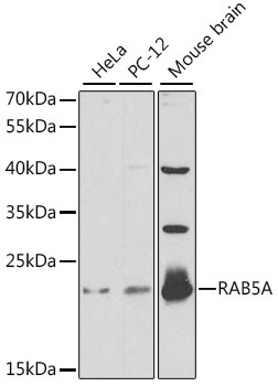 RAB5A Antibody