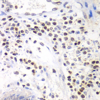 SMARCA4 Antibody