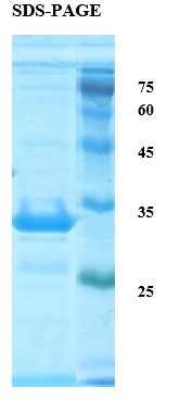Deamidated Gliadin Peptide Antigen Recombinant Protein