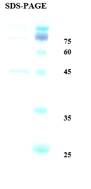 Deamidated Gliadin Peptide Antigen Recombinant Protein