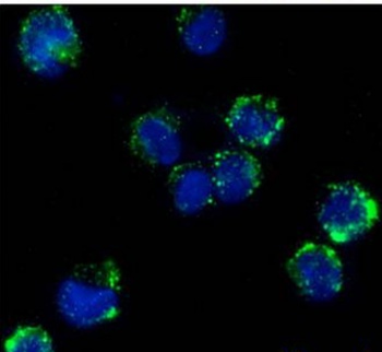 Fc gamma receptor III Antibody [3G8], Rabbit IgG