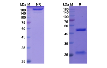 Quilizumab (IGHE) - Research Grade Biosimilar Antibody