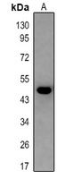 5-HT2B Rabbit Polyclonal Antibody