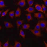 5-HT2B Rabbit Polyclonal Antibody