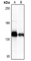 Collagen 1 alpha 1 Antibody