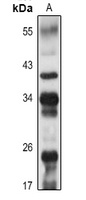 CD20 Rabbit Polyclonal Antibody