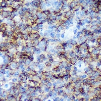 CD20 Rabbit Polyclonal Antibody