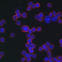 CD20 Rabbit Polyclonal Antibody