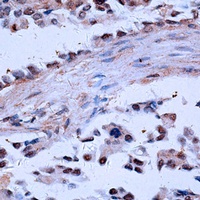 NCOA4 Rabbit Polyclonal Antibody
