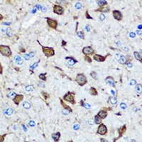 Parvalbumin alpha Rabbit Polyclonal Antibody