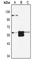 EPO Receptor Rabbit Polyclonal Antibody