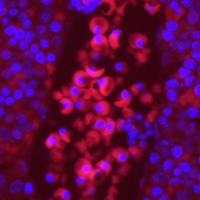 EPO Receptor Rabbit Polyclonal Antibody