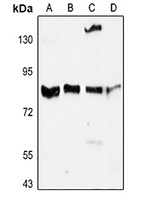 MMP9 Rabbit Polyclonal Antibody