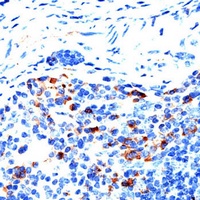 MMP9 Rabbit Polyclonal Antibody