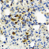 IL-1 beta Rabbit Polyclonal Antibody