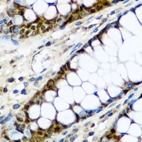 Cyclin D1 Rabbit Polyclonal Antibody