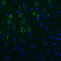 NEFM Rabbit Polyclonal Antibody
