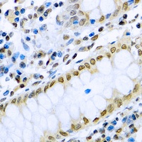 IRF3 Rabbit Polyclonal Antibody