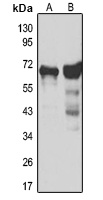 GAD1 Rabbit Polyclonal Antibody