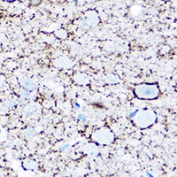 GAD1 Rabbit Polyclonal Antibody