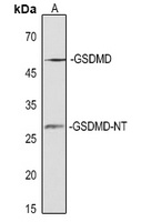 GSDMD-NT Rabbit Polyclonal Antibody