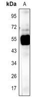 Rubisco Large Chain Rabbit Polyclonal Antibody