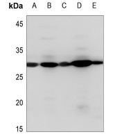 PDGFB Antibody