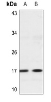 Histone H3 (MonoMethyl-K56) Antibody