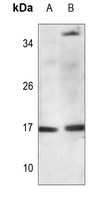 Histone H3 (Butyryl-K9) Rabbit Polyclonal Antibody