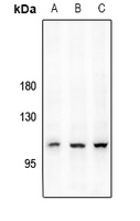 CD167a (Phospho-Y792) Rabbit Polyclonal Antibody