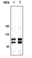 CIITA Rabbit Polyclonal Antibody