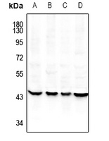 ILF2 Rabbit Polyclonal Antibody