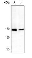 CD339 Rabbit Polyclonal Antibody