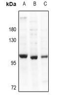 mGLUR2 Rabbit Polyclonal Antibody