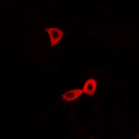 mGLUR2 Rabbit Polyclonal Antibody