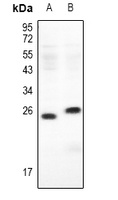 Ephrin A3 Rabbit Polyclonal Antibody