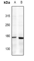 Collagen 5 alpha 1 Rabbit Polyclonal Antibody