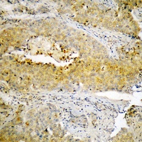 ECM1 Rabbit Polyclonal Antibody