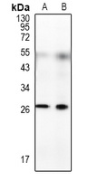 RFPL4B Rabbit Polyclonal Antibody