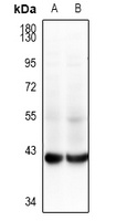 GALM Rabbit Polyclonal Antibody