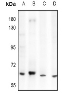 ACOT12 Rabbit Polyclonal Antibody